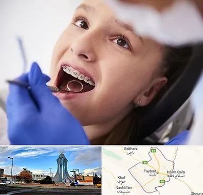 دکتر ارتودنسی کودکان در تایباد