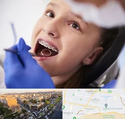 دکتر ارتودنسی کودکان در تهرانپارس