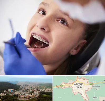 دکتر ارتودنسی کودکان در گرگان