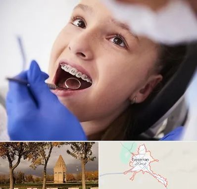 دکتر ارتودنسی کودکان در تویسرکان