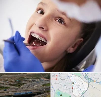 دکتر ارتودنسی کودکان در یاغچیان تبریز