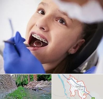 دکتر ارتودنسی کودکان در سراوان