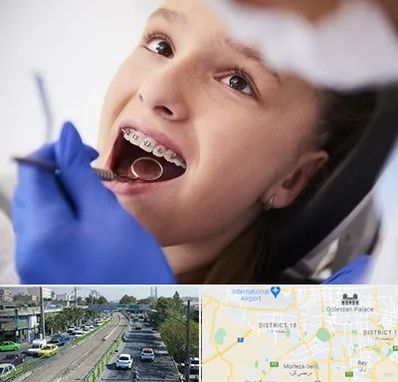 دکتر ارتودنسی کودکان در جنوب تهران