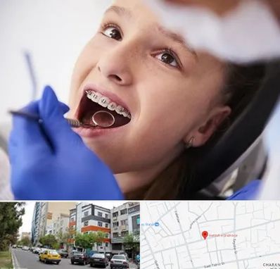 دکتر ارتودنسی کودکان در هفده شهریور تبریز