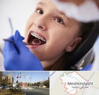 دکتر ارتودنسی کودکان در مشکین دشت
