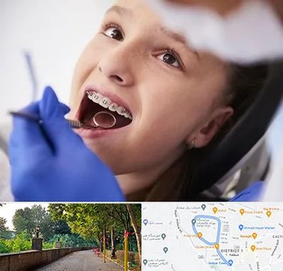 دکتر ارتودنسی کودکان در بلوار گیلان رشت