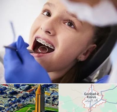 دکتر ارتودنسی کودکان در گنبد کاووس