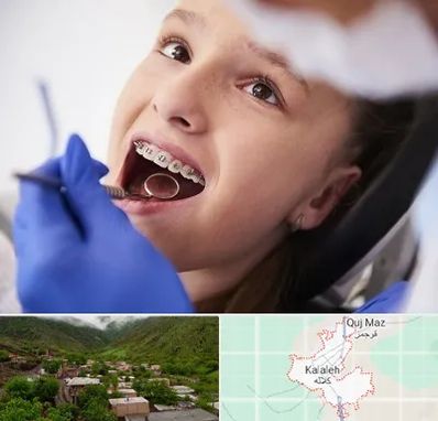 دکتر ارتودنسی کودکان در کلاله