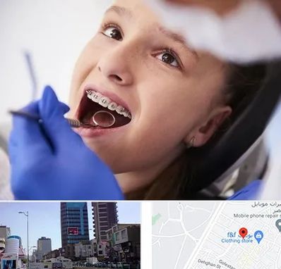 دکتر ارتودنسی کودکان در چهارراه طالقانی کرج