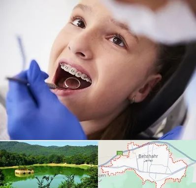 دکتر ارتودنسی کودکان در بهشهر