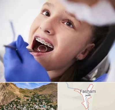 دکتر ارتودنسی کودکان در فشم