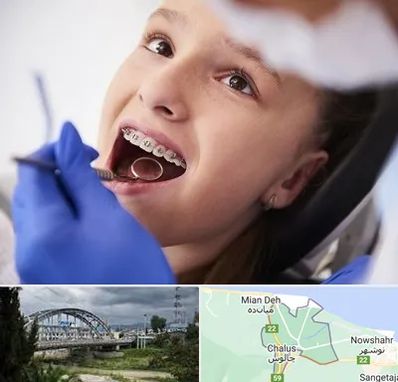 دکتر ارتودنسی کودکان در چالوس