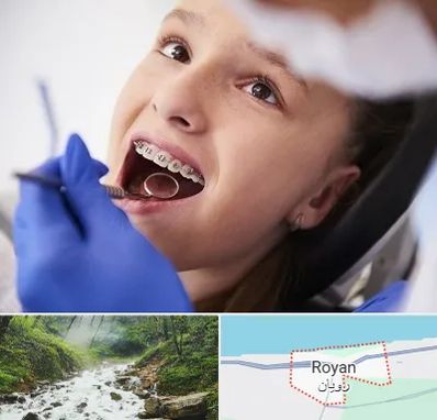 دکتر ارتودنسی کودکان در رویان