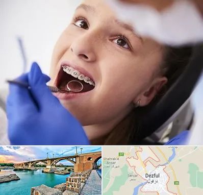 دکتر ارتودنسی کودکان در دزفول