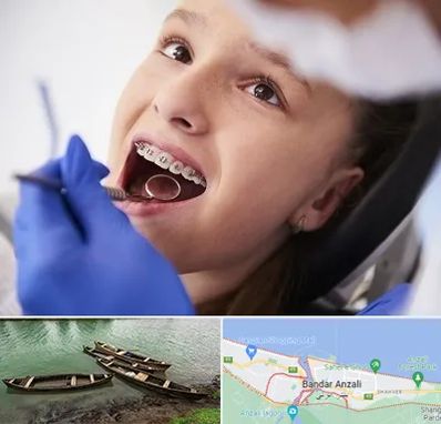 دکتر ارتودنسی کودکان در بندر انزلی