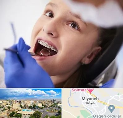 دکتر ارتودنسی کودکان در میانه
