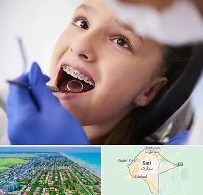 دکتر ارتودنسی کودکان در ساری