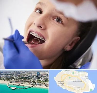 دکتر ارتودنسی کودکان در کیش