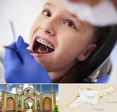 دکتر ارتودنسی کودکان در سمنان