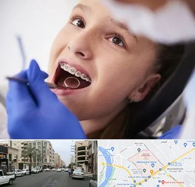 دکتر ارتودنسی کودکان در زیتون کارمندی اهواز