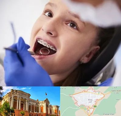 دکتر ارتودنسی کودکان در خوی