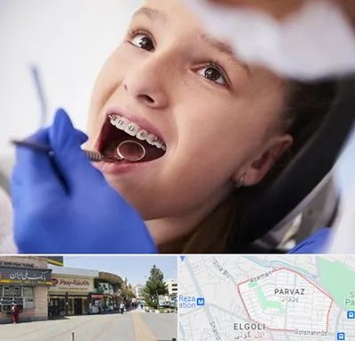 دکتر ارتودنسی کودکان در پرواز تبریز