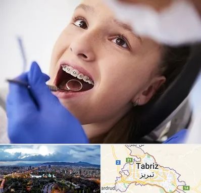 دکتر ارتودنسی کودکان در تبریز