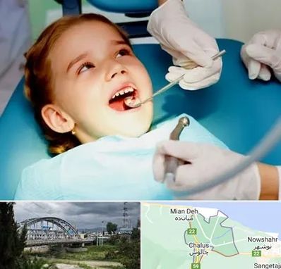 دندانپزشکی اطفال در چالوس