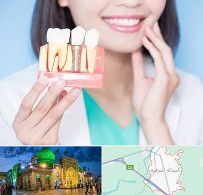 متخصص ایمپلنت در آستانه اشرفیه