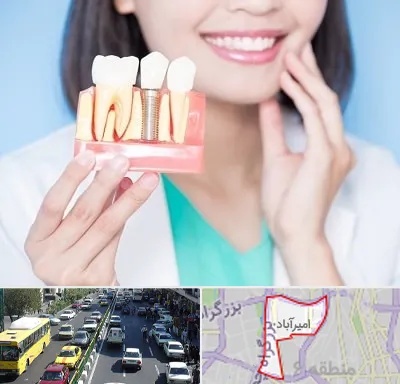متخصص ایمپلنت در امیرآباد