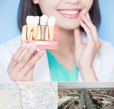 متخصص ایمپلنت در حصارک کرج