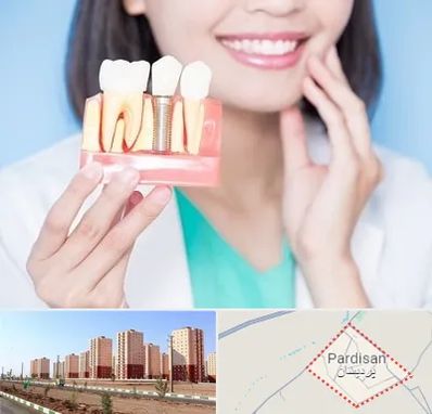 متخصص ایمپلنت در پردیسان قم