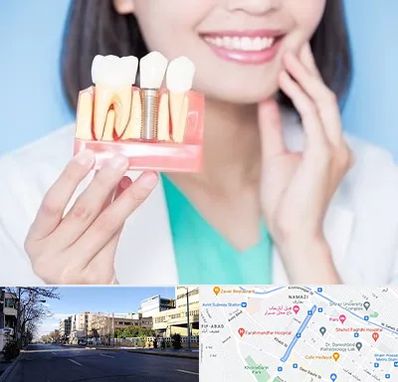متخصص ایمپلنت در خیابان ملاصدرا شیراز