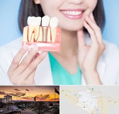 متخصص ایمپلنت در قوچان