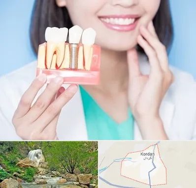 متخصص ایمپلنت در کردان