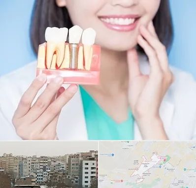 متخصص ایمپلنت در محمد شهر کرج