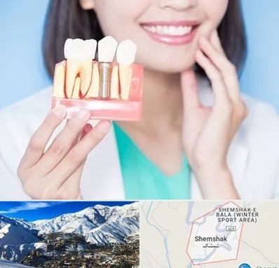 متخصص ایمپلنت در شمشک