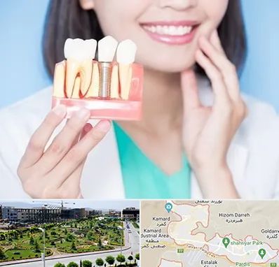 متخصص ایمپلنت در پردیس
