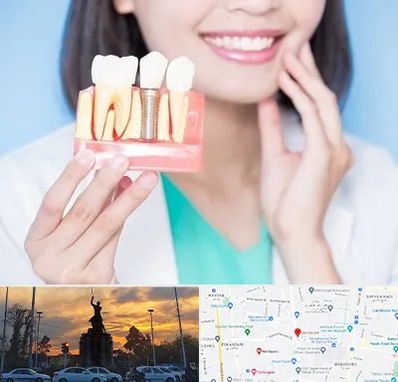 متخصص ایمپلنت در میدان حر