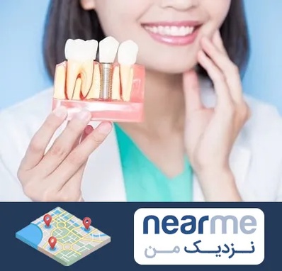 متخصص ایمپلنت در نزدیک من