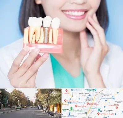 متخصص ایمپلنت در شریعتی