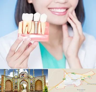 متخصص ایمپلنت در سمنان