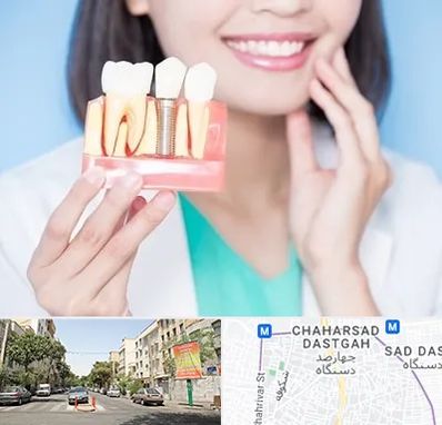 متخصص ایمپلنت در چهارصد دستگاه