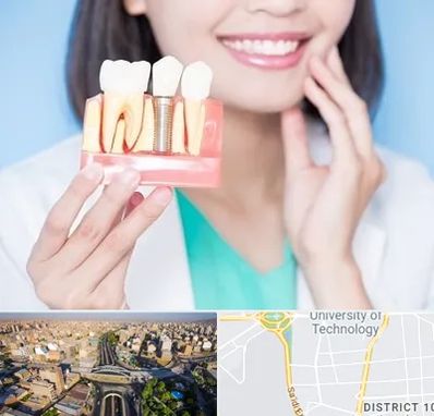 متخصص ایمپلنت در استاد معین