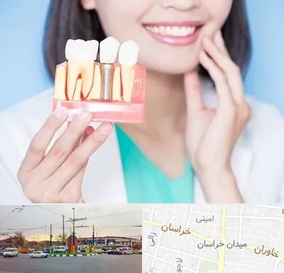 متخصص ایمپلنت در میدان خراسان
