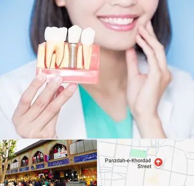 متخصص ایمپلنت در 15 خرداد