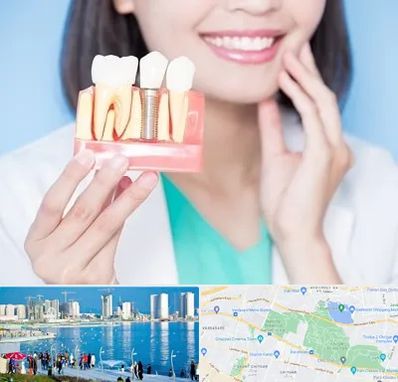 متخصص ایمپلنت در چیتگر