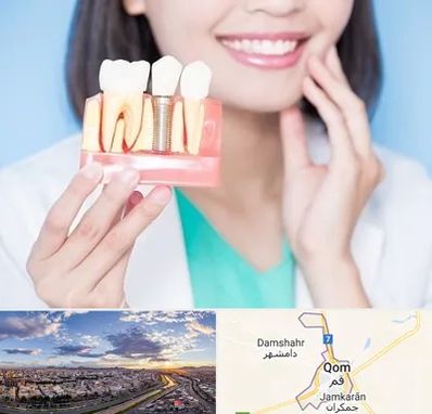 متخصص ایمپلنت در قم