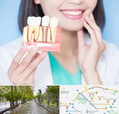 متخصص ایمپلنت در خیابان ارم شیراز