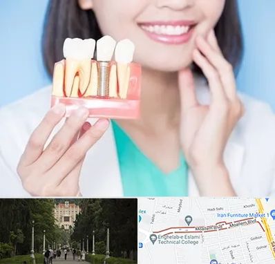 متخصص ایمپلنت در بلوار معلم رشت